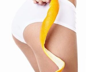 Top 10 Ways to Get Rid of Cellulite