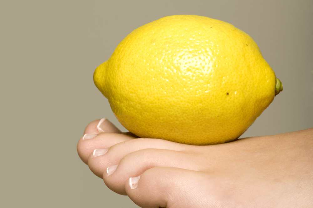 put-lemon-on-yellow-toenails-