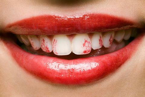 lipstick-on-teeth-