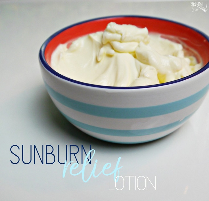 Sunburn-Relief-Lotion