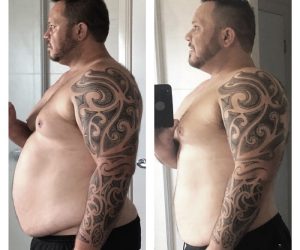 Tattoos After Weight Loss: What Happens to Tattoos After Weight Loss?