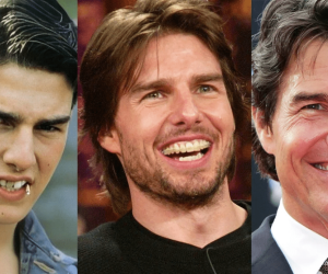13 Celebrities with Full Dentures (With Pictures)