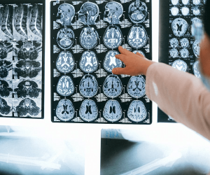 6 Tips To Help You Regain Quality Of Life After A Brain Injury