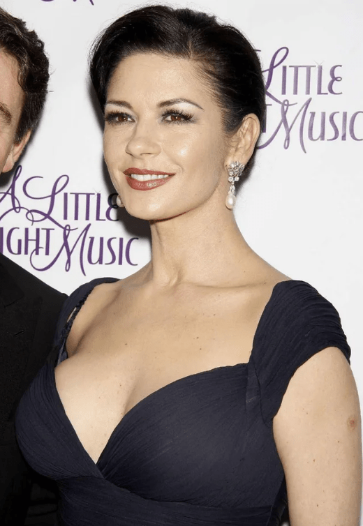 Catherine-Zeta-Jones-Droopy-Eyelid Catherine-Zeta-Jones-Droopy-Eyelid