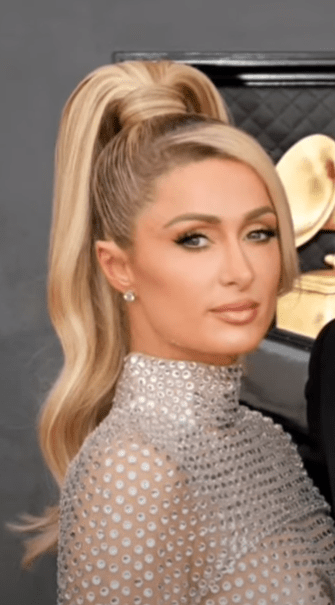 Paris-Hilton-Droopy-Eyelid Paris-Hilton-Droopy-Eyelid