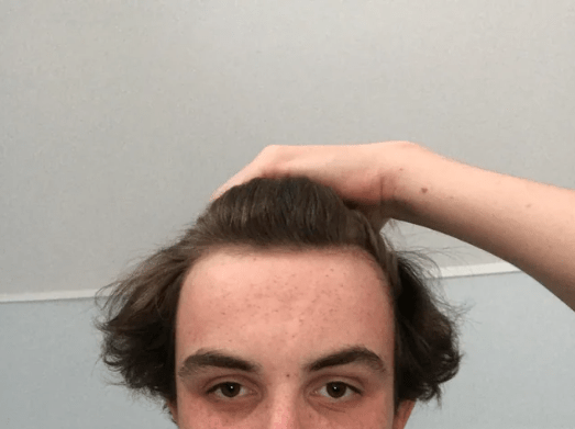 Measuring-Forehead-Size