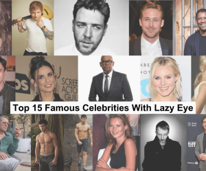 Top 15 Famous Celebrities With Lazy Eye