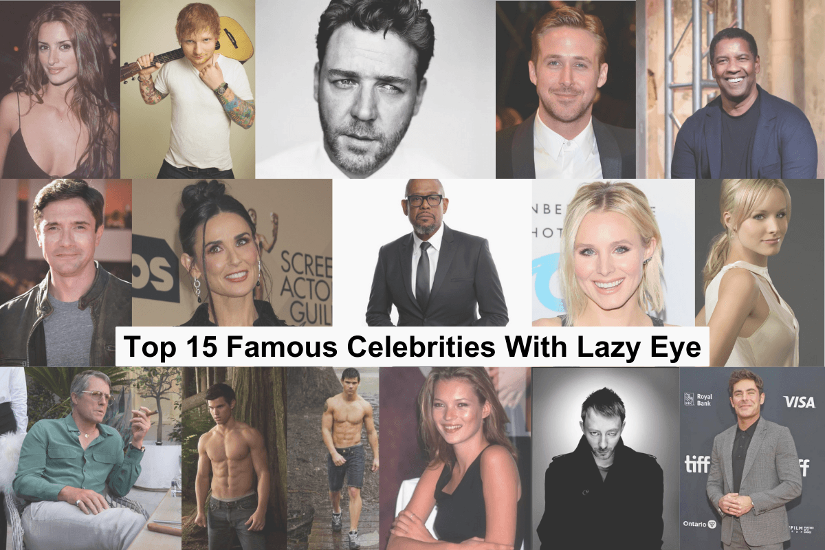 Top 15 Famous Celebrities With Lazy Eye