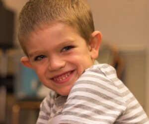 Famous People with Fragile X Syndrome You Should Know