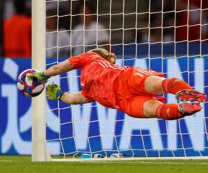 7 Famous People With Vitiligo Who Inspire Millions