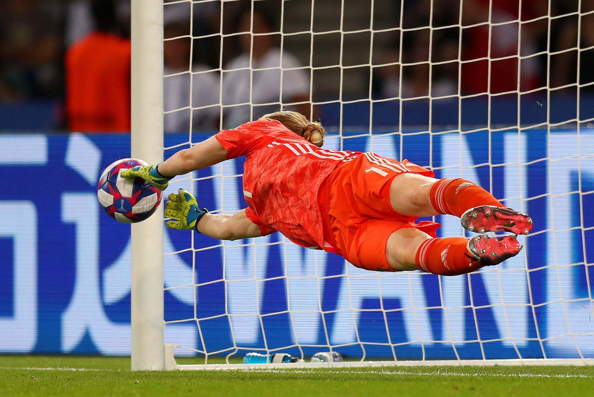 Famous People With Vitiligo Who Inspire Millions