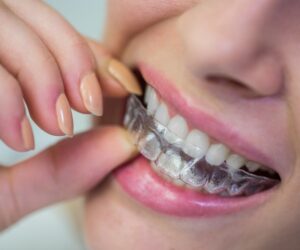 Top 8 Reasons Invisalign May Be Worth Considering for Your Smile